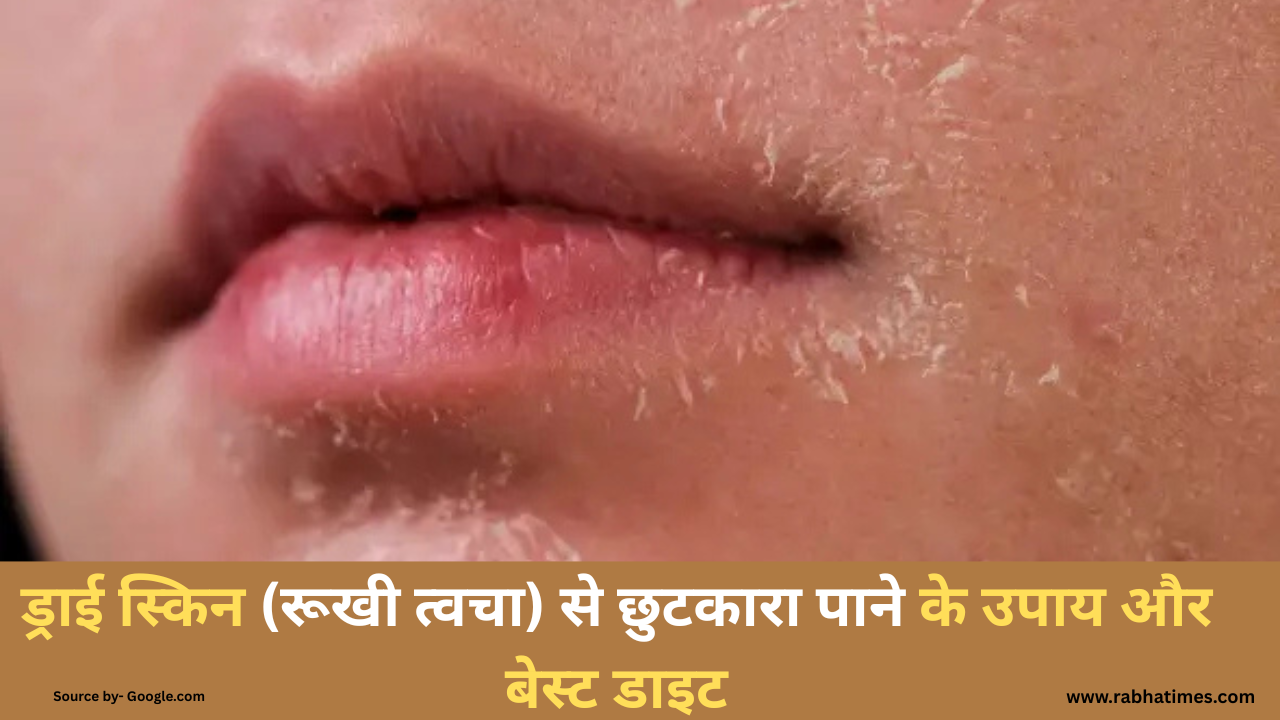 ड्राई स्किन (रूखी त्वचा) से छुटकारा पाने के उपाय और बेस्ट डाइट